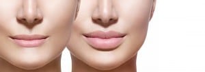 Lip Fillers