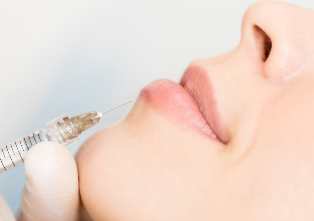 Dermal Fillers
