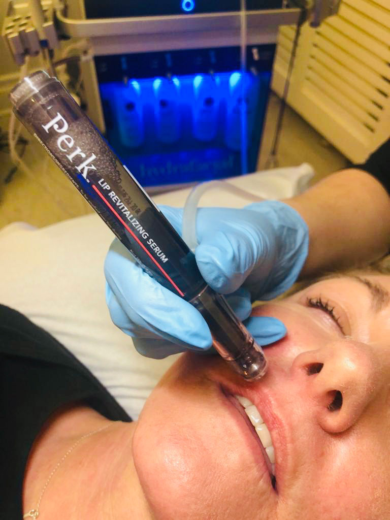 HydraFacial Perk Lip treatment