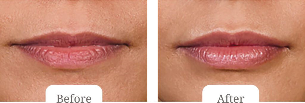 Autumn Package - Replenish Lip Moisture Levels